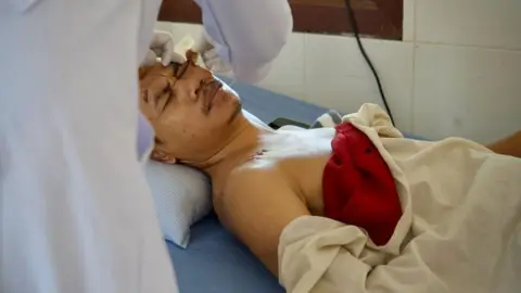 Bloody Battlefield: Cambodia Faces Heavy Toll in Escalating Border Conflict with Thailand